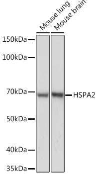 HSPA2 Rabbit mAb