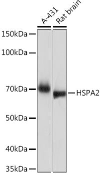 HSPA2 Rabbit mAb