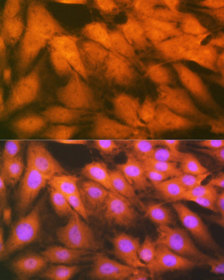 HSPA2 Rabbit mAb