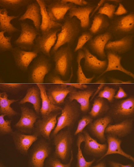 HSPA2 Rabbit mAb