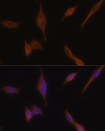 MLPH Rabbit pAb