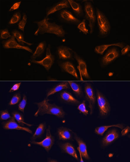 MLPH Rabbit pAb