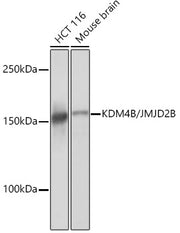 KDM4B/JMJD2B Rabbit mAb