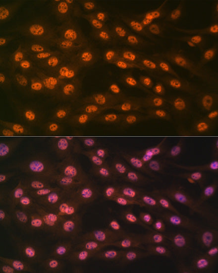 KDM4B/JMJD2B Rabbit mAb