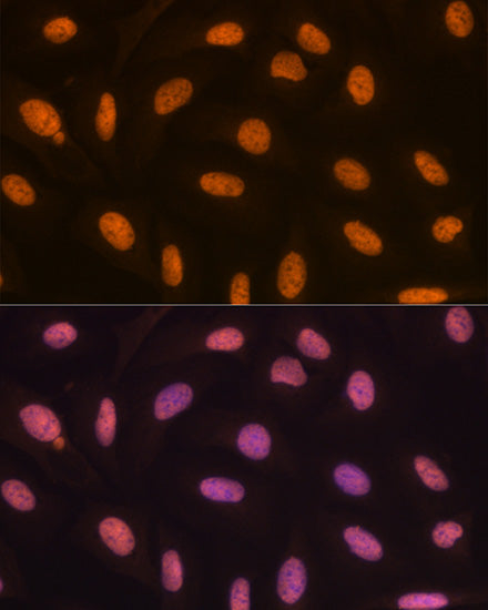 KDM4B/JMJD2B Rabbit mAb