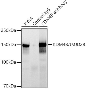KDM4B/JMJD2B Rabbit mAb