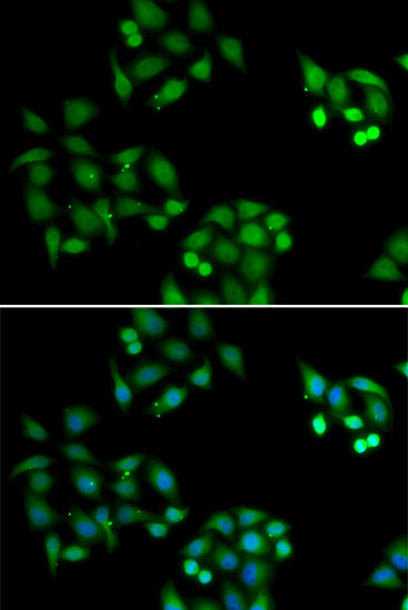 NSFL1C Rabbit pAb