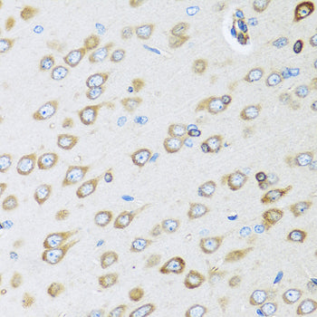 Osteoglycin (OGN) Rabbit pAb