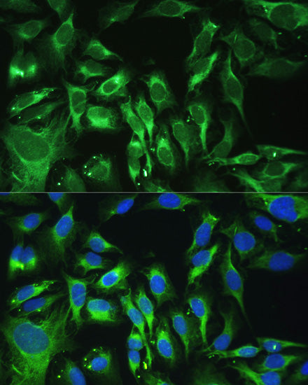 Osteoglycin (OGN) Rabbit pAb