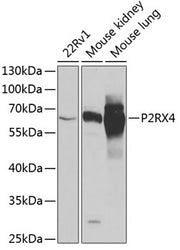 P2RX4 Rabbit pAb