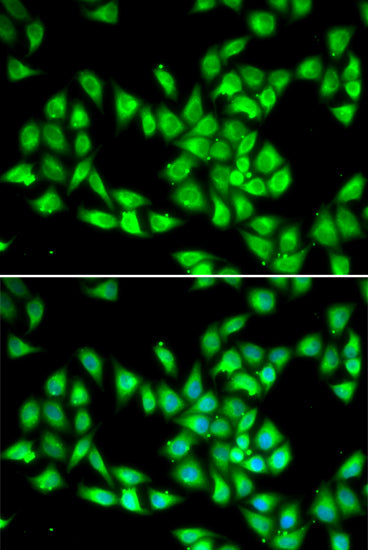 PCMT1 Rabbit pAb