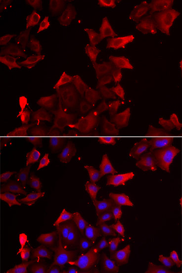PDLIM1/CLP36 Rabbit pAb