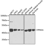 PPM1A Rabbit pAb