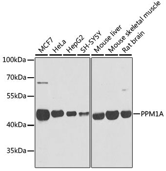 PPM1A Rabbit pAb