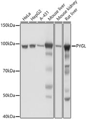 PYGL Rabbit pAb