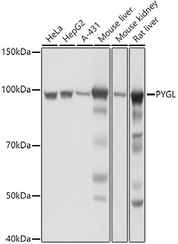PYGL Rabbit pAb