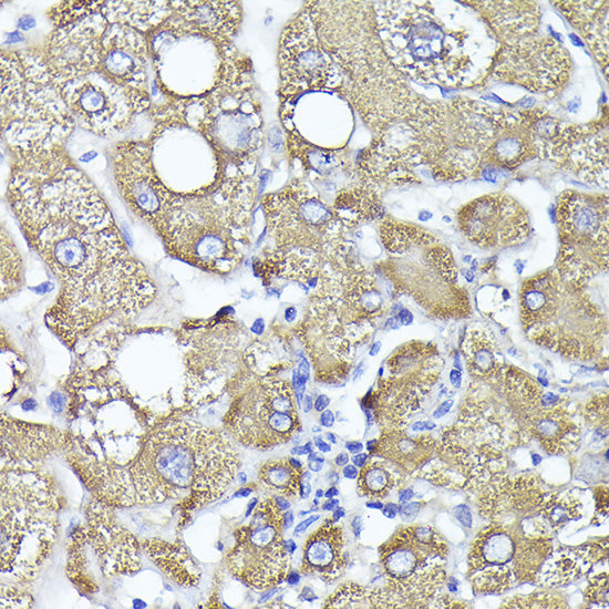 PYGL Rabbit pAb