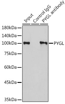 PYGL Rabbit pAb