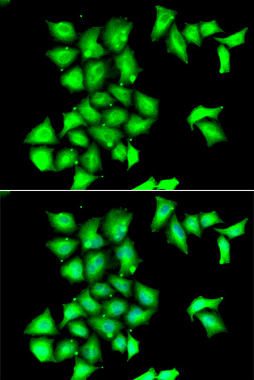 MSRB1 Rabbit pAb
