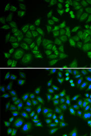 SMPD1 / ASM Rabbit pAb