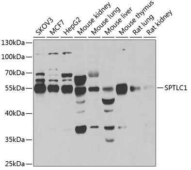 SPTLC1 Rabbit pAb