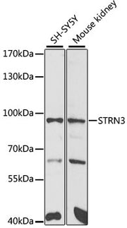 STRN3 Rabbit pAb