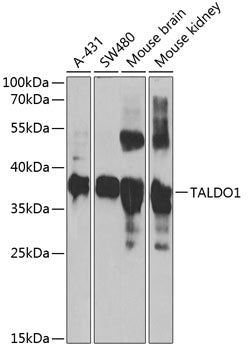 TALDO1 Rabbit pAb