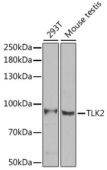 [KO Validated] TLK2 Rabbit pAb