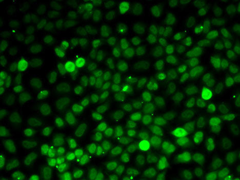 Exportin 5 (XPO5) Rabbit pAb