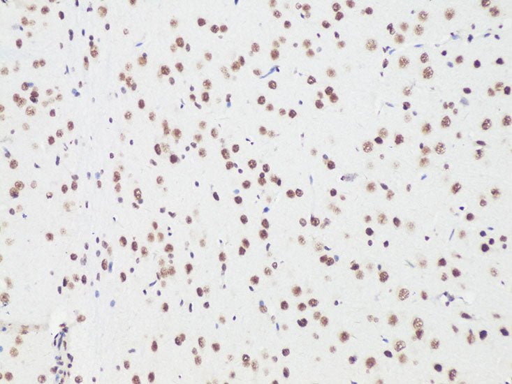 Bcl9 Rabbit pAb