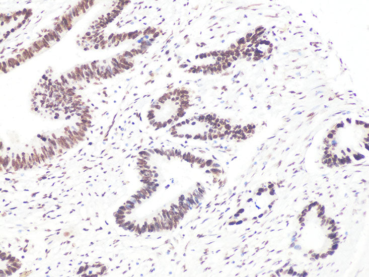 Bcl9 Rabbit pAb