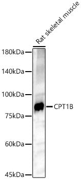 CPT1B Rabbit pAb