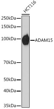ADAM15 Rabbit mAb