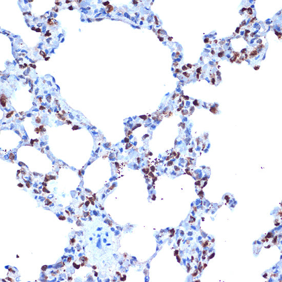 ADAM15 Rabbit mAb