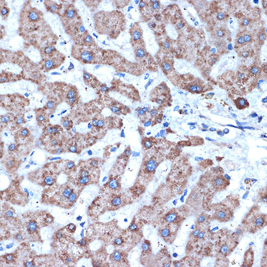 ADAM15 Rabbit mAb