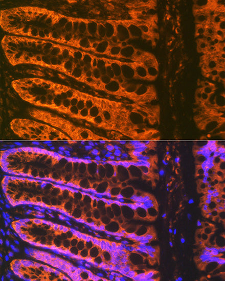 ADAM15 Rabbit mAb