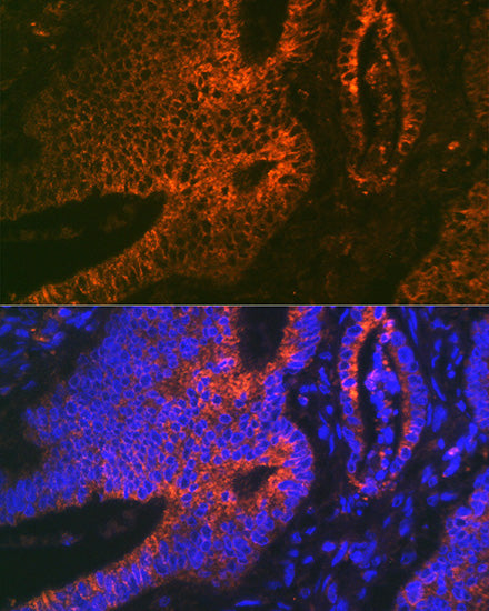 ADAM15 Rabbit mAb