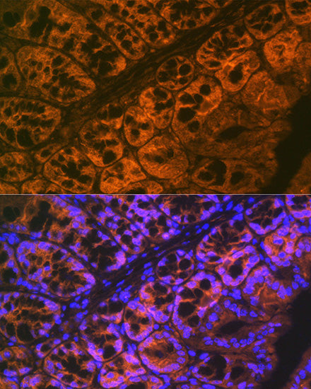 ADAM15 Rabbit mAb
