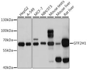 GTF2H1 Rabbit pAb