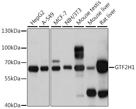 GTF2H1 Rabbit pAb