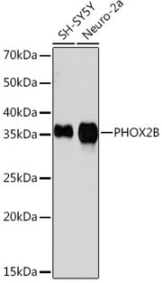 PHOX2B Rabbit mAb