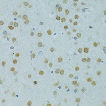 MUS81 Rabbit pAb