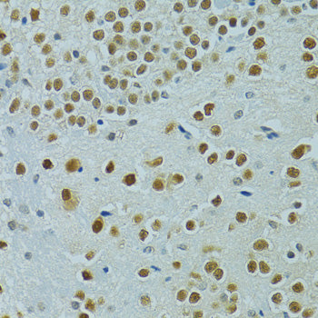 MUS81 Rabbit pAb