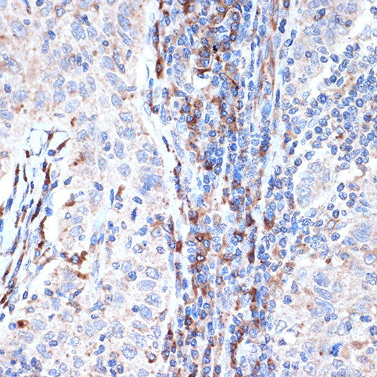DCP1A Rabbit mAb