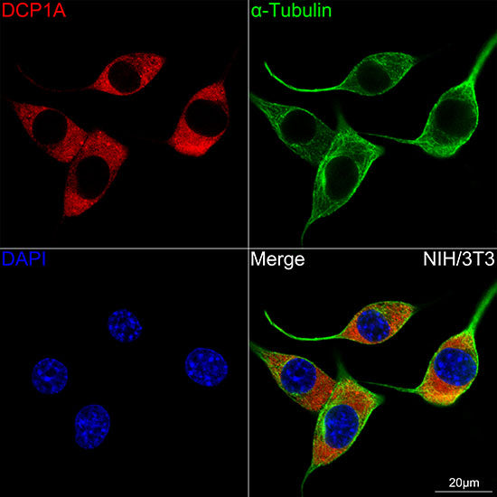 DCP1A Rabbit mAb