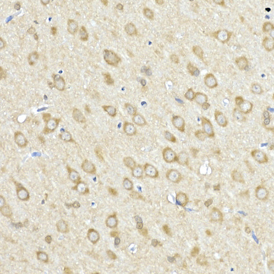 ACSL4 Rabbit pAb