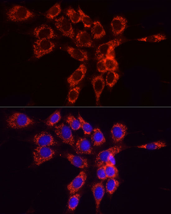ACSL4 Rabbit pAb