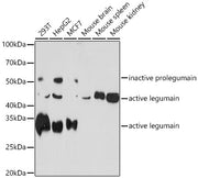 Legumain (LGMN) Rabbit mAb