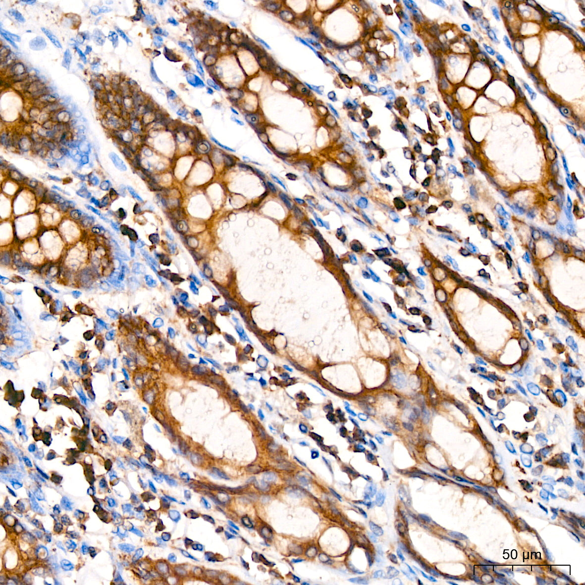 α-Tubulin Rabbit mAb
