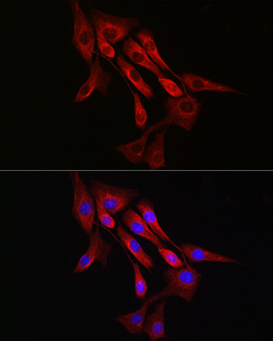 α-Tubulin Rabbit mAb